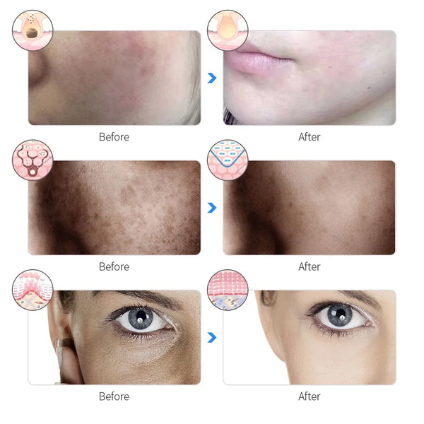 Máscara Facial LED Recargable